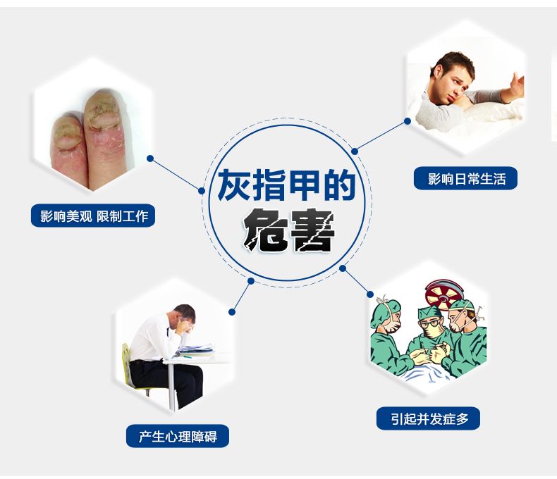 苏州哪家皮肤病医院可以治好灰指甲