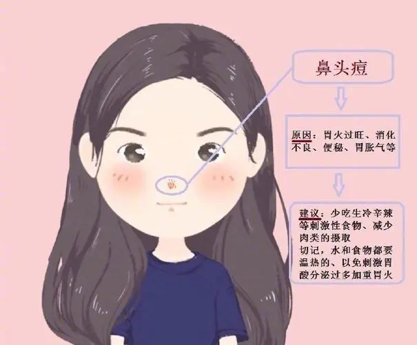 痘痘经常复发怎么办