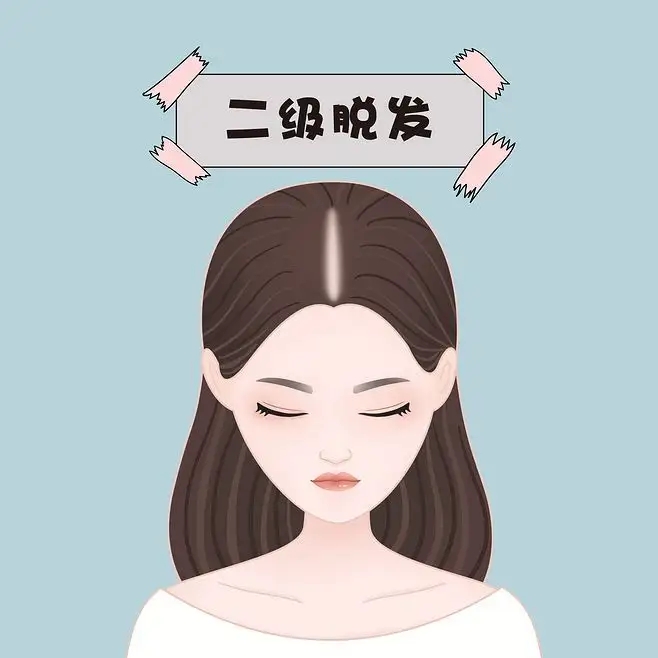 头发掉了很多怎么办